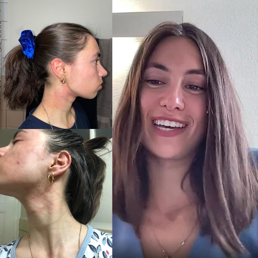 Alice, avant et après